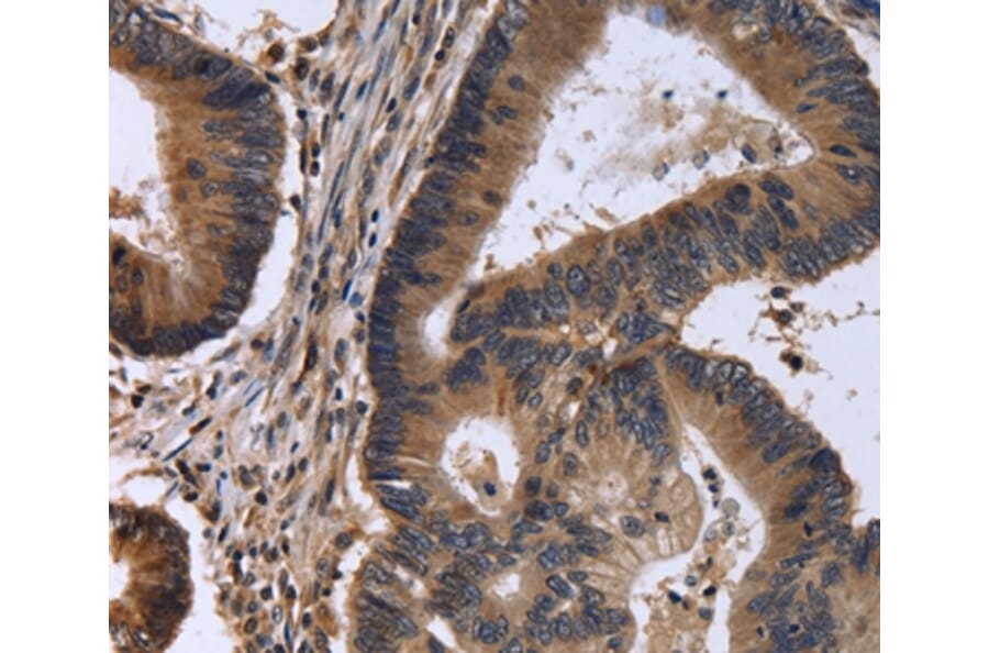 Immunohistochemistry - FSTL1 Antibody from Signalway Antibody (36488) - Antibodies.com