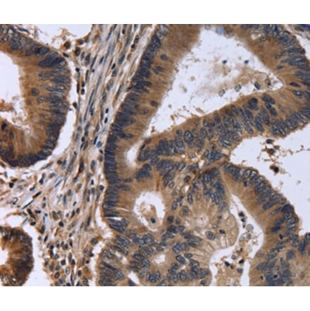 Immunohistochemistry - FSTL1 Antibody from Signalway Antibody (36488) - Antibodies.com