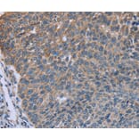 Immunohistochemistry - GNAI3 Antibody from Signalway Antibody (36493) - Antibodies.com