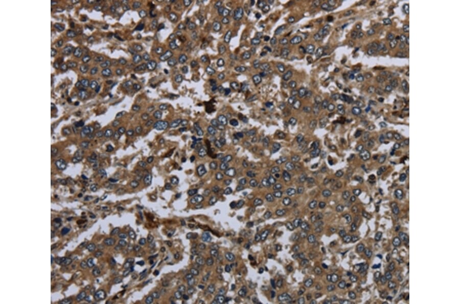 Immunohistochemistry - GP1BA Antibody from Signalway Antibody (36512) - Antibodies.com