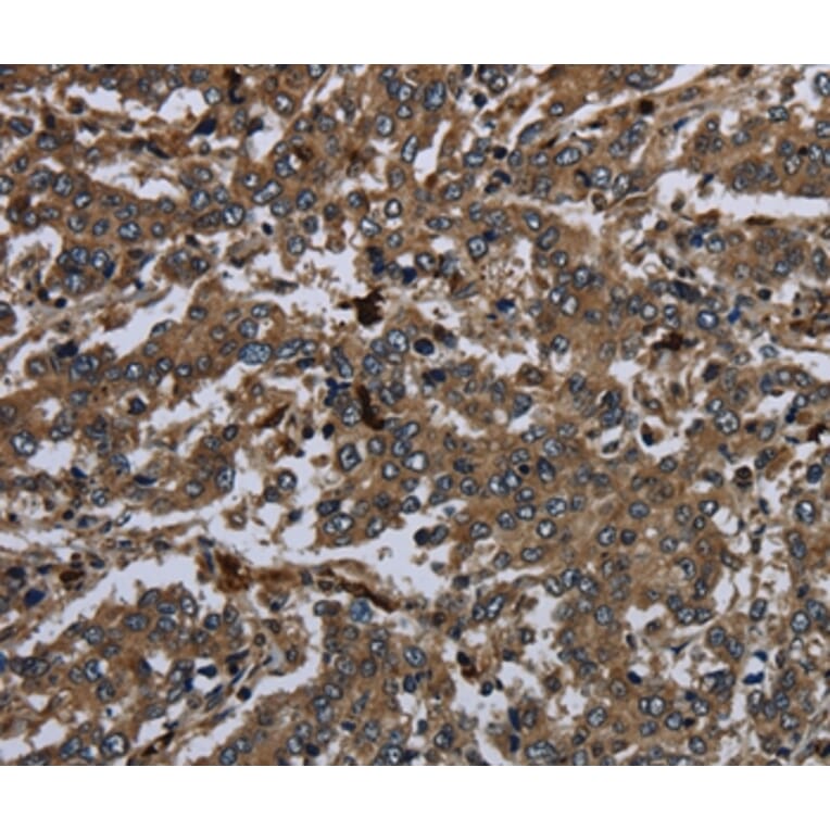 Immunohistochemistry - GP1BA Antibody from Signalway Antibody (36512) - Antibodies.com