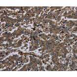 Immunohistochemistry - GP1BA Antibody from Signalway Antibody (36512) - Antibodies.com