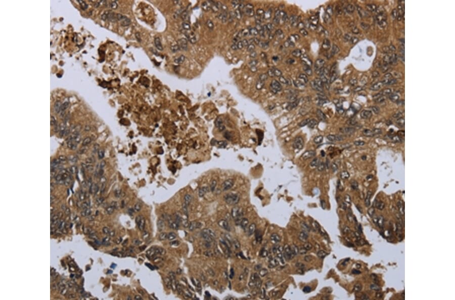 Immunohistochemistry - GP1BA Antibody from Signalway Antibody (36512) - Antibodies.com