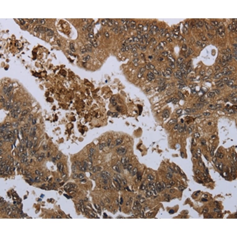 Immunohistochemistry - GP1BA Antibody from Signalway Antibody (36512) - Antibodies.com