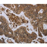 Immunohistochemistry - GP1BA Antibody from Signalway Antibody (36512) - Antibodies.com