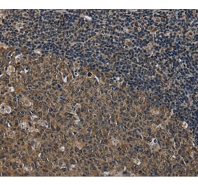 Immunohistochemistry - SETD7 Antibody from Signalway Antibody (36520) - Antibodies.com