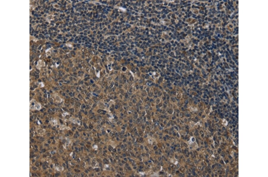 Immunohistochemistry - SETD7 Antibody from Signalway Antibody (36520) - Antibodies.com