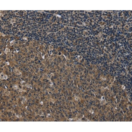 Immunohistochemistry - SETD7 Antibody from Signalway Antibody (36520) - Antibodies.com