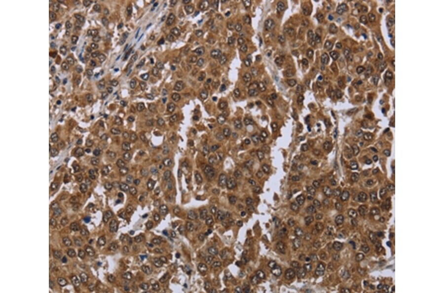 Immunohistochemistry - SETD7 Antibody from Signalway Antibody (36520) - Antibodies.com