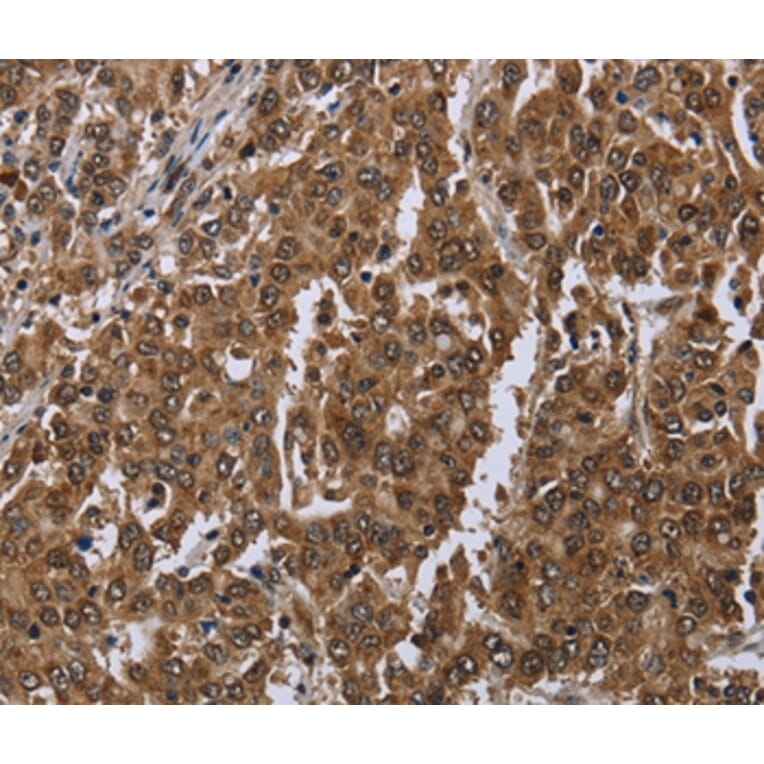 Immunohistochemistry - SETD7 Antibody from Signalway Antibody (36520) - Antibodies.com