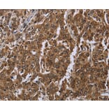Immunohistochemistry - SETD7 Antibody from Signalway Antibody (36520) - Antibodies.com