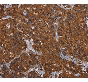 Immunohistochemistry - HYAL2 Antibody from Signalway Antibody (36539) - Antibodies.com