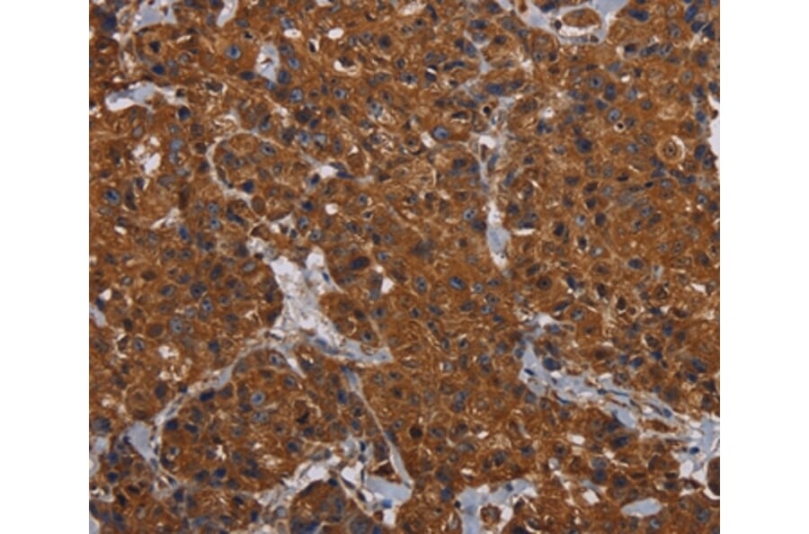 Immunohistochemistry - HYAL2 Antibody from Signalway Antibody (36539) - Antibodies.com