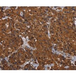Immunohistochemistry - HYAL2 Antibody from Signalway Antibody (36539) - Antibodies.com