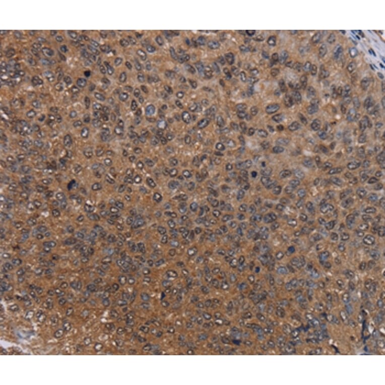 Immunohistochemistry - HYAL2 Antibody from Signalway Antibody (36539) - Antibodies.com