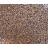 Immunohistochemistry - HYAL2 Antibody from Signalway Antibody (36539) - Antibodies.com