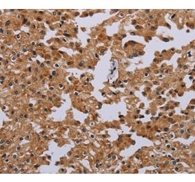 Immunohistochemistry - IFRD1 Antibody from Signalway Antibody (36546) - Antibodies.com