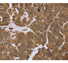 Immunohistochemistry - IKBIP Antibody from Signalway Antibody (36550) - Antibodies.com