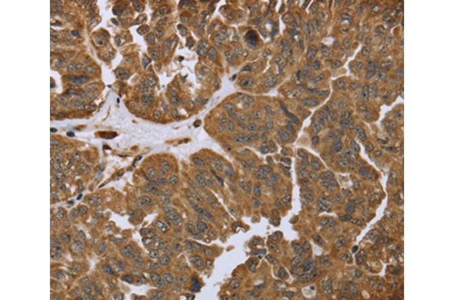 Immunohistochemistry - IKBIP Antibody from Signalway Antibody (36550) - Antibodies.com