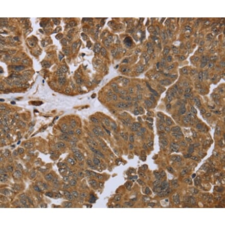 Immunohistochemistry - IKBIP Antibody from Signalway Antibody (36550) - Antibodies.com