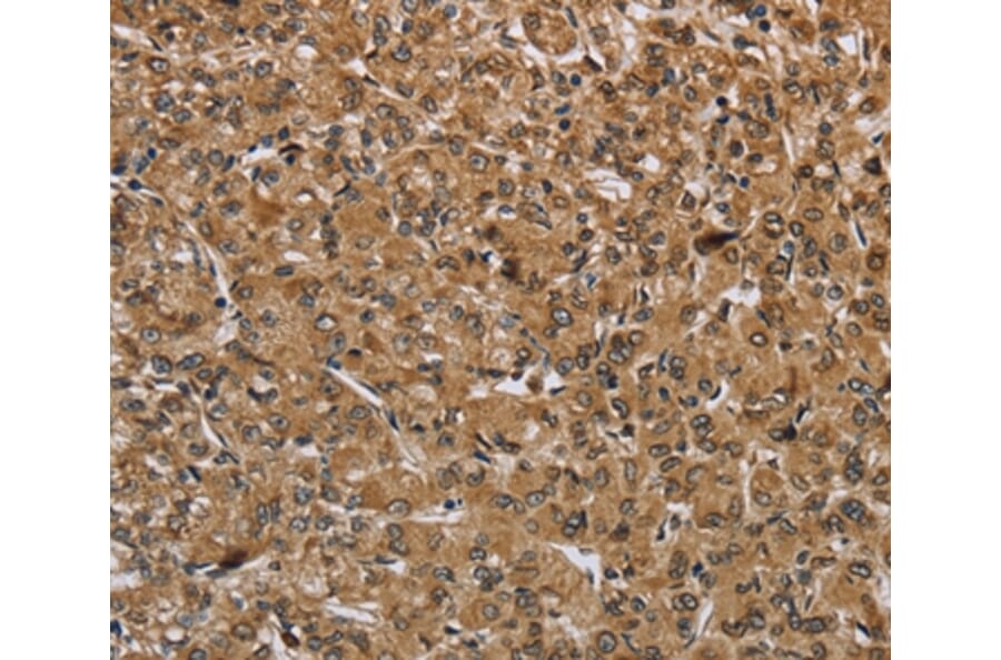 Immunohistochemistry - IKBIP Antibody from Signalway Antibody (36550) - Antibodies.com