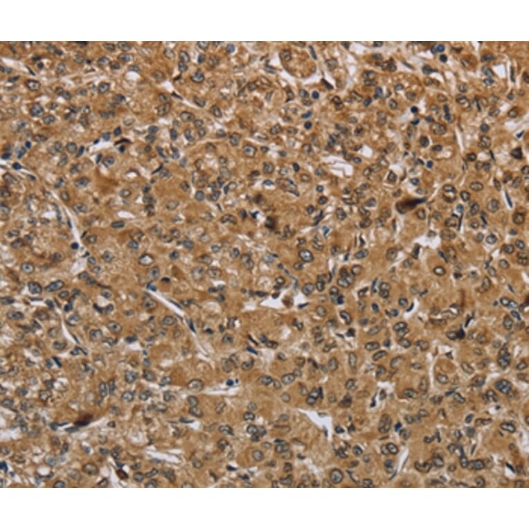 Immunohistochemistry - IKBIP Antibody from Signalway Antibody (36550) - Antibodies.com