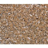 Immunohistochemistry - IKBIP Antibody from Signalway Antibody (36550) - Antibodies.com