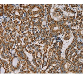 Immunohistochemistry - IPO13 Antibody from Signalway Antibody (36554) - Antibodies.com