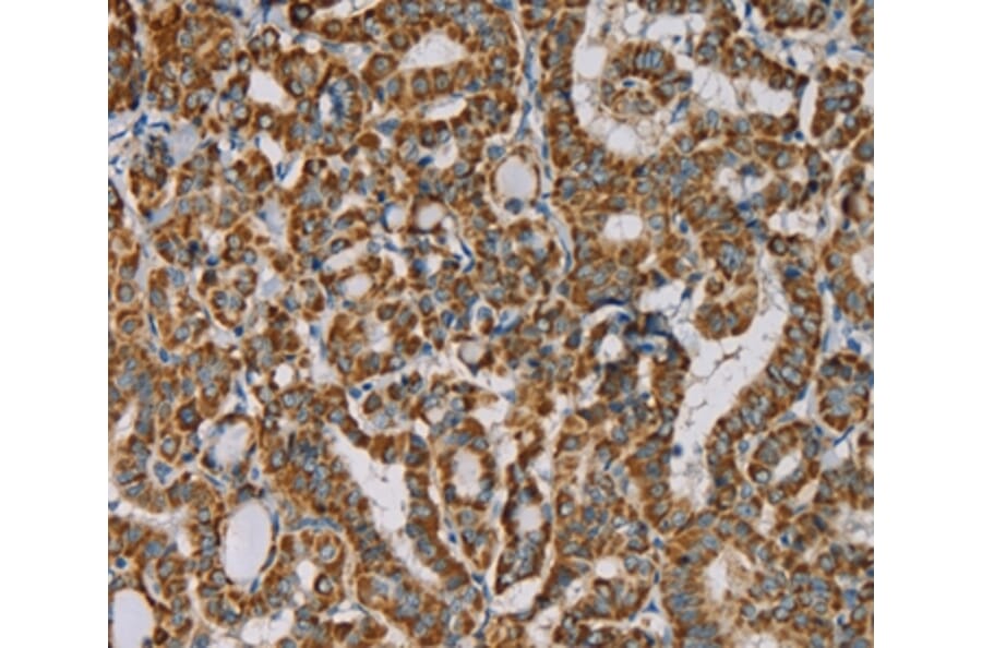 Immunohistochemistry - IPO13 Antibody from Signalway Antibody (36554) - Antibodies.com