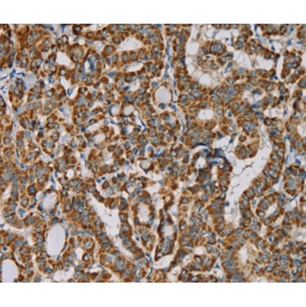 Immunohistochemistry - IPO13 Antibody from Signalway Antibody (36554) - Antibodies.com