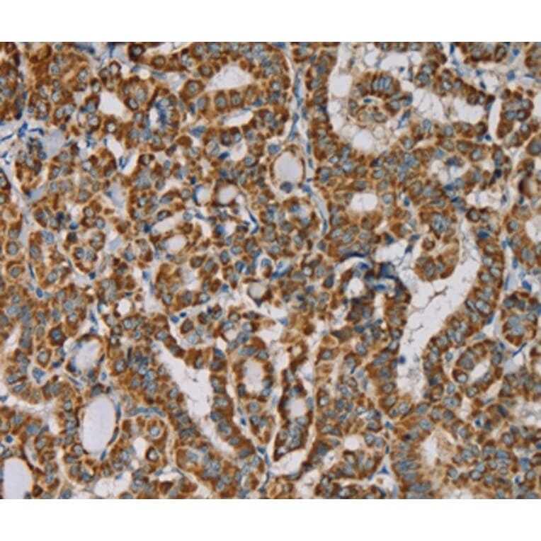 Immunohistochemistry - IPO13 Antibody from Signalway Antibody (36554) - Antibodies.com