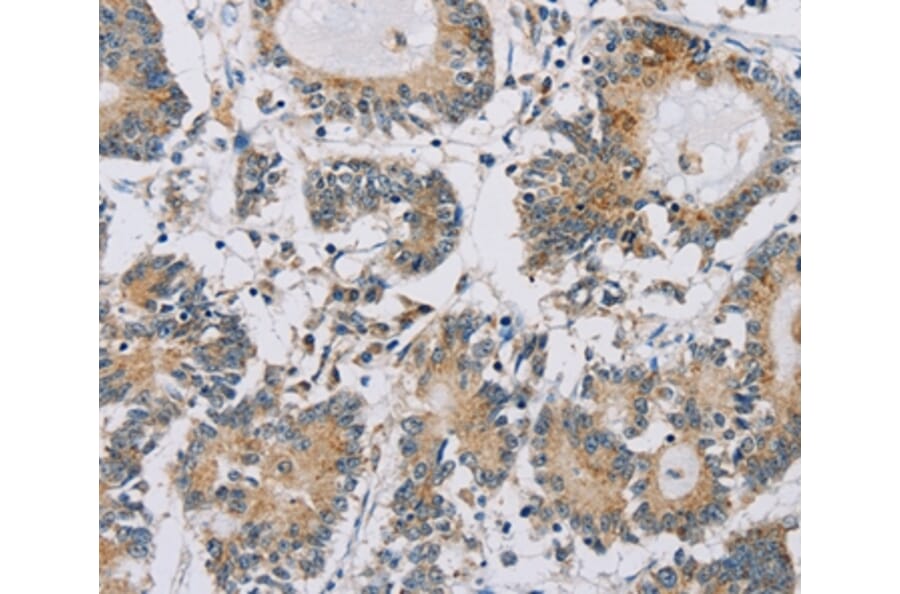 Immunohistochemistry - IPO13 Antibody from Signalway Antibody (36554) - Antibodies.com