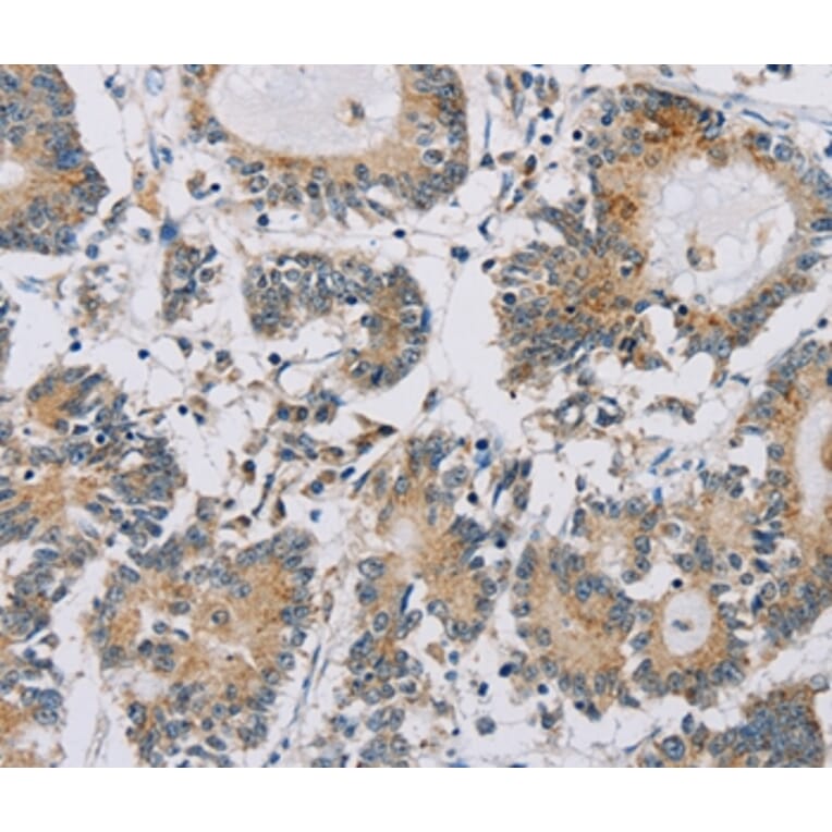Immunohistochemistry - IPO13 Antibody from Signalway Antibody (36554) - Antibodies.com