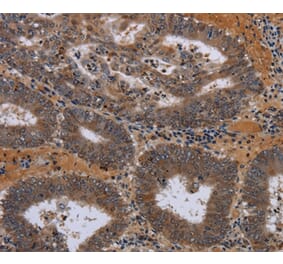 Immunohistochemistry - JMJD7 Antibody from Signalway Antibody (36564) - Antibodies.com