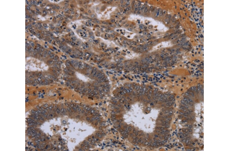 Immunohistochemistry - JMJD7 Antibody from Signalway Antibody (36564) - Antibodies.com