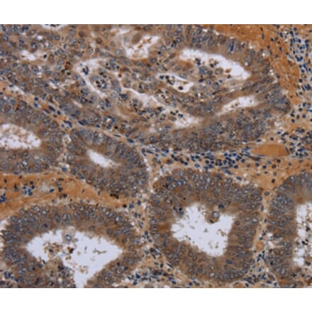 Immunohistochemistry - JMJD7 Antibody from Signalway Antibody (36564) - Antibodies.com
