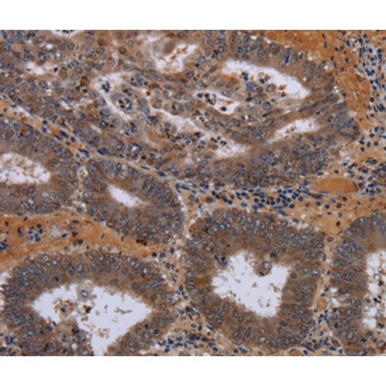 Immunohistochemistry - JMJD7 Antibody from Signalway Antibody (36564) - Antibodies.com