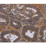 Immunohistochemistry - JMJD7 Antibody from Signalway Antibody (36564) - Antibodies.com