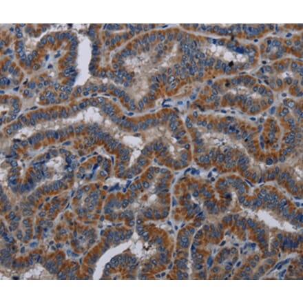 Immunohistochemistry - KLK11 Antibody from Signalway Antibody (36576) - Antibodies.com