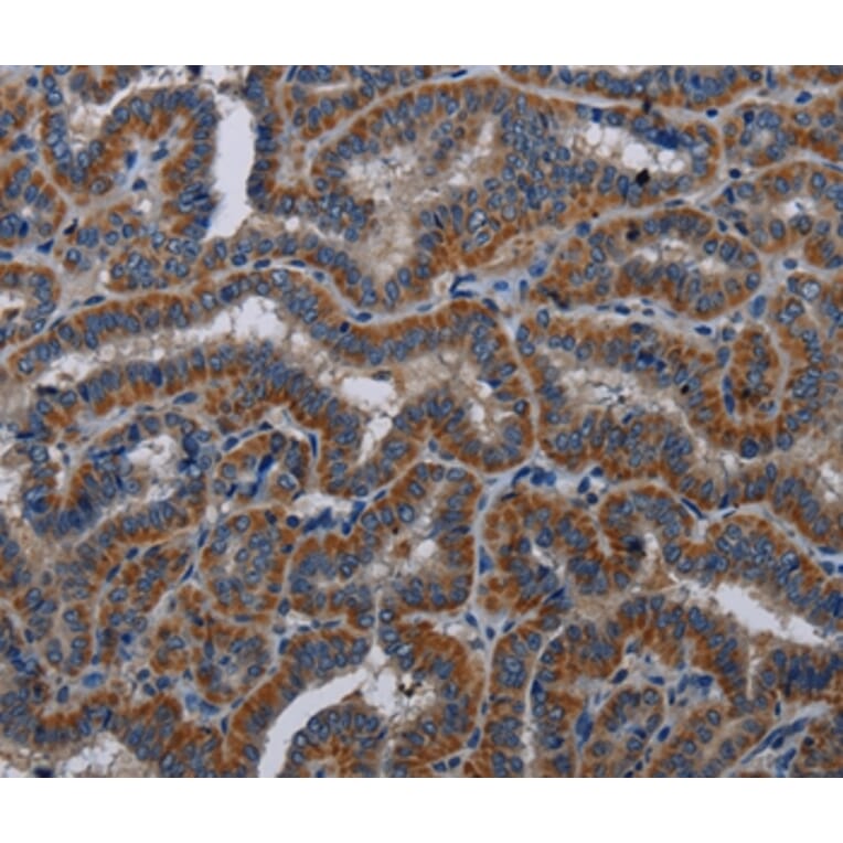 Immunohistochemistry - KLK11 Antibody from Signalway Antibody (36576) - Antibodies.com