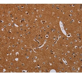 Immunohistochemistry - KLK13 Antibody from Signalway Antibody (36578) - Antibodies.com