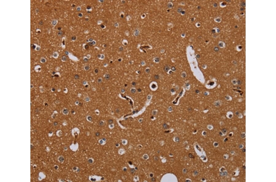 Immunohistochemistry - KLK13 Antibody from Signalway Antibody (36578) - Antibodies.com