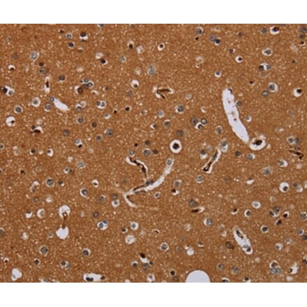Immunohistochemistry - KLK13 Antibody from Signalway Antibody (36578) - Antibodies.com