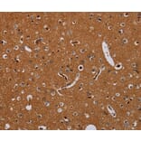 Immunohistochemistry - KLK13 Antibody from Signalway Antibody (36578) - Antibodies.com