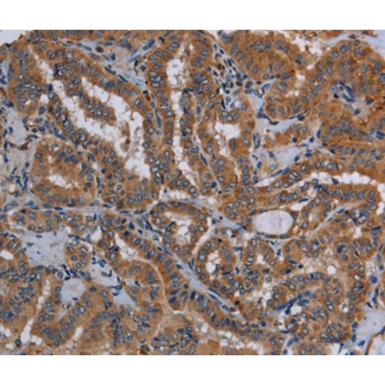 Immunohistochemistry - KLK13 Antibody from Signalway Antibody (36578) - Antibodies.com