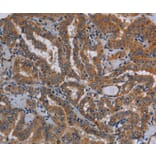 Immunohistochemistry - KLK13 Antibody from Signalway Antibody (36578) - Antibodies.com
