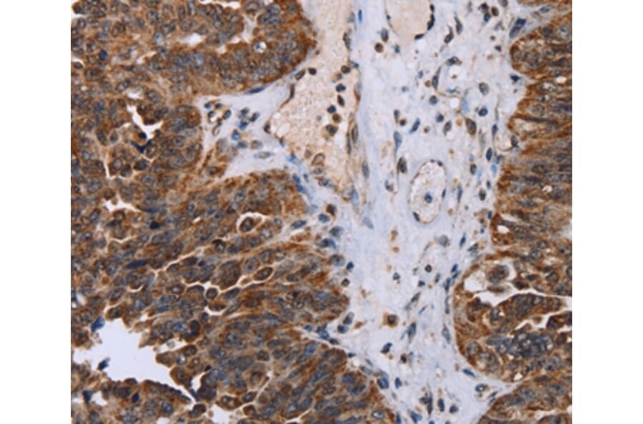Immunohistochemistry - DDX11 Antibody from Signalway Antibody (36579) - Antibodies.com