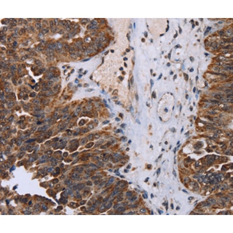 Immunohistochemistry - DDX11 Antibody from Signalway Antibody (36579) - Antibodies.com