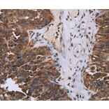 Immunohistochemistry - DDX11 Antibody from Signalway Antibody (36579) - Antibodies.com