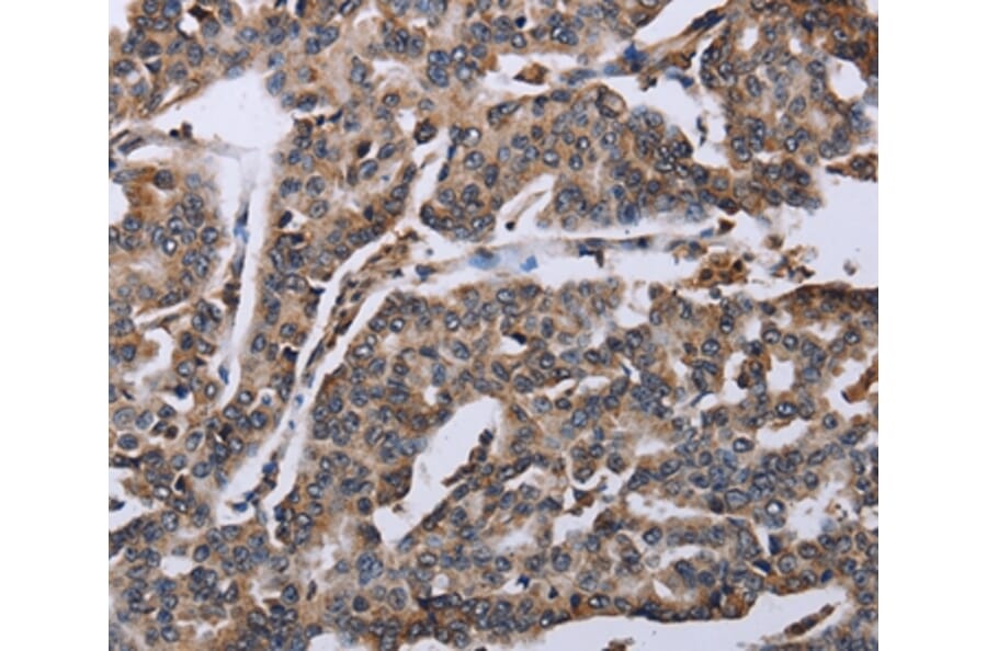 Immunohistochemistry - DDX11 Antibody from Signalway Antibody (36579) - Antibodies.com